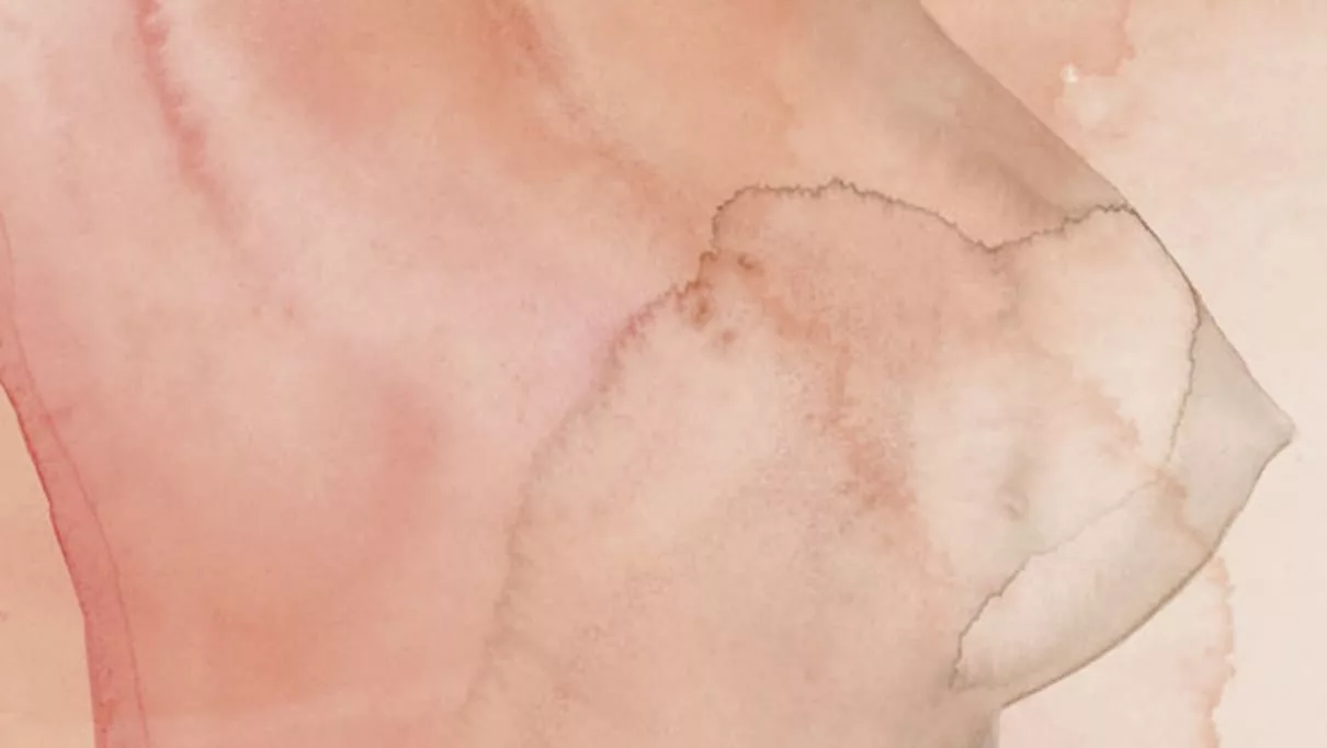 56396 - Pesquisa brasileira revela como alguns cânceres de mama escapam do tratamento