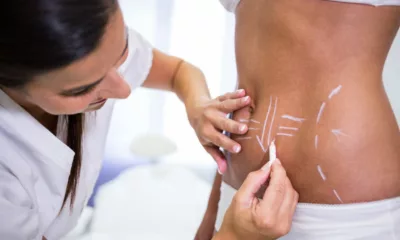 cirurgia estetica z - Por que a estética preventiva virou obsessão da Geração Z?