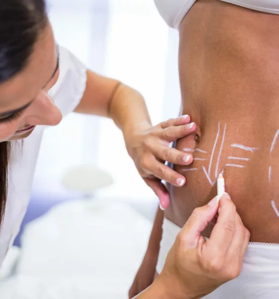 cirurgia estetica z - Por que a estética preventiva virou obsessão da Geração Z?