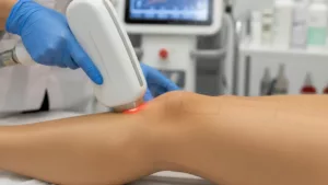 Quanto custa uma depilação a laser no corpo inteiro e por que o valor varia tanto