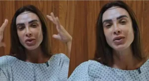 Nicole Bahls fez transplante capilar após alopecia: “Vou ficar muito mais cabeluda”