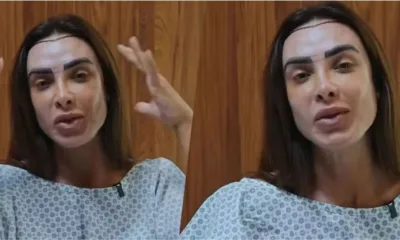 nicole - Nicole Bahls fez transplante capilar após alopecia: "Vou ficar muito mais cabeluda"