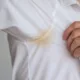 roupa mancha amarela - Como remover manchas amarelas de camisas brancas nas axilas (e evitar que voltem)
