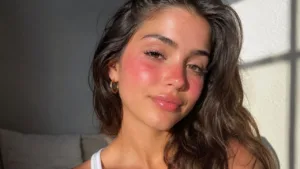 Sunburn blush vira febre nas redes sociais: entenda por que imitar a queimadura de sol preocupa quem cuida da pele