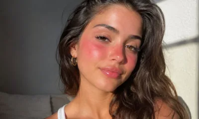 blush sol 1 - Sunburn blush vira febre nas redes sociais: entenda por que imitar a queimadura de sol preocupa quem cuida da pele