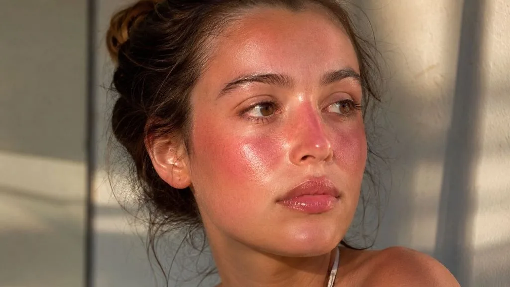 blush sol 2 - Sunburn blush vira febre nas redes sociais: entenda por que imitar a queimadura de sol preocupa quem cuida da pele